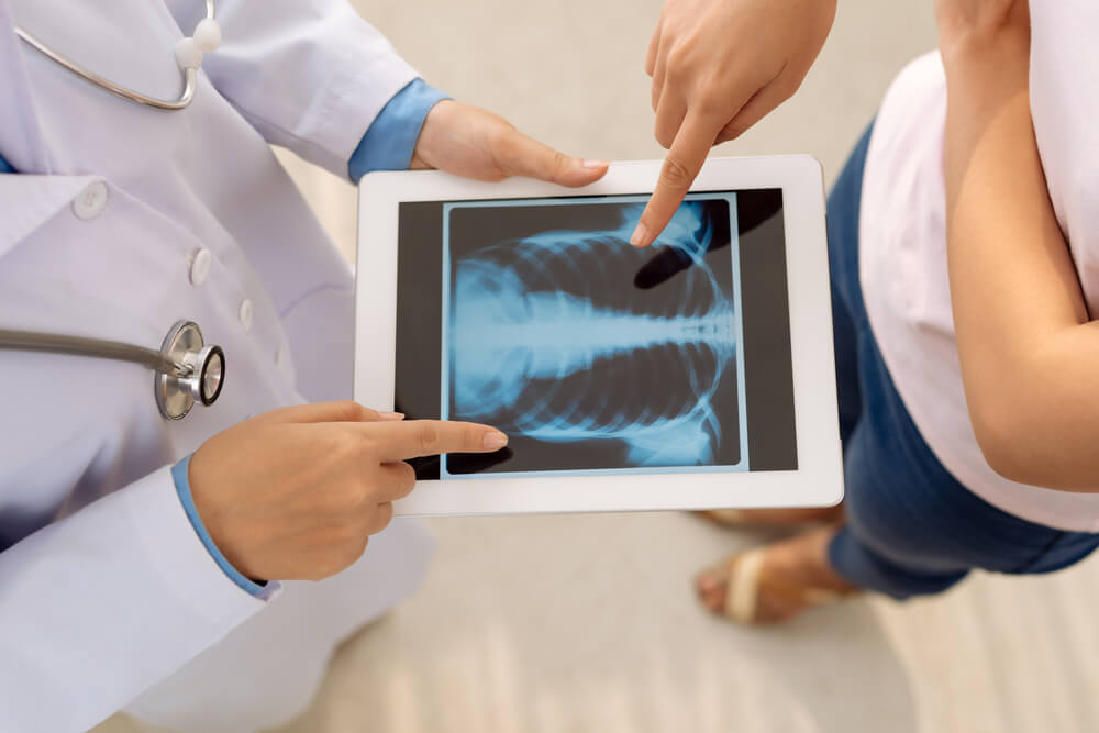 Doctor showing chest x-ray on digital tablet to patient
